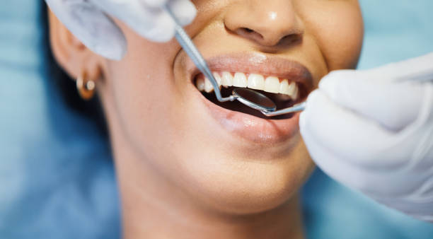 Best Emergency Dentist for Lost Fillings or Crowns in Clermont, GA